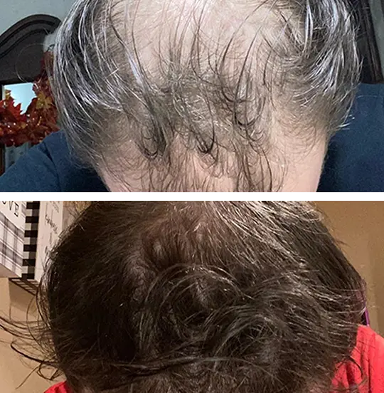 Root Activator Shampoo™ - Sale 30 real result 3